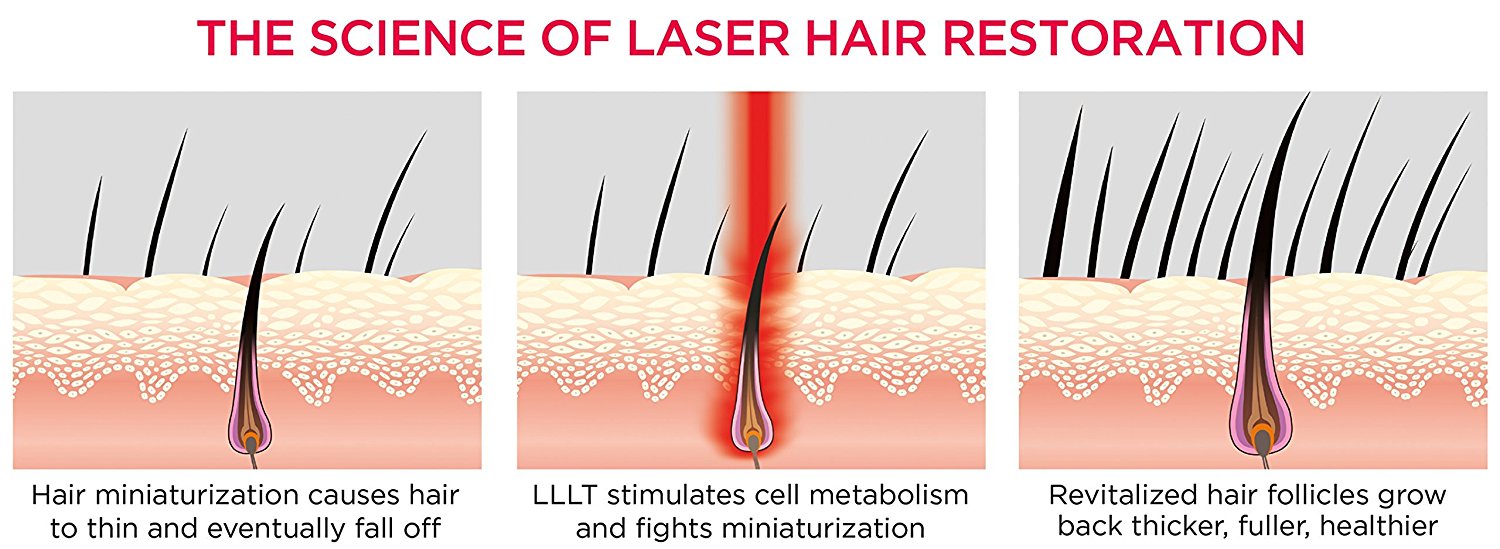 Low Level Laser Therapy (LLLT) | Musk