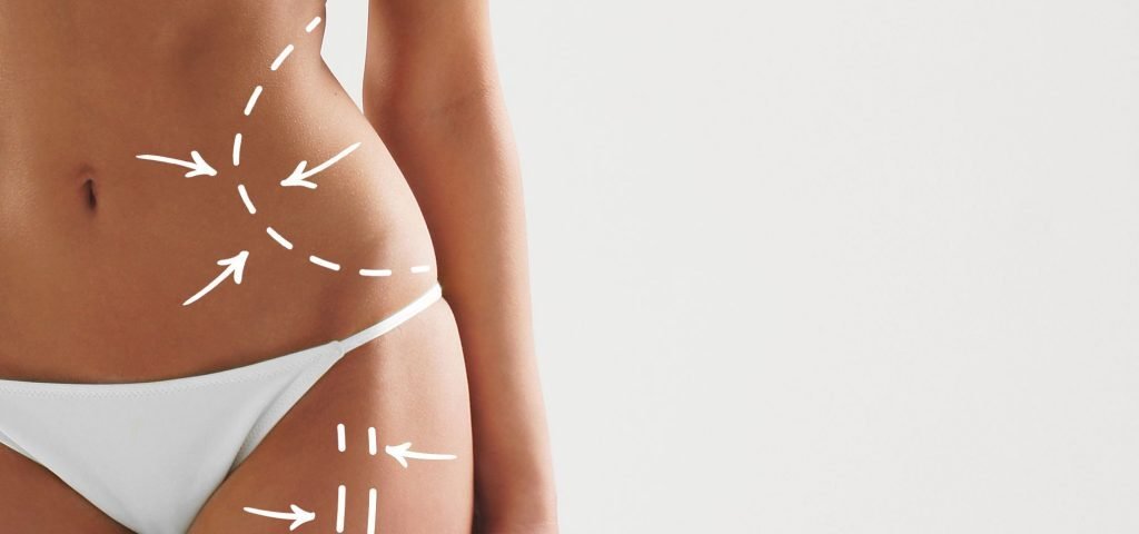 Body contouring