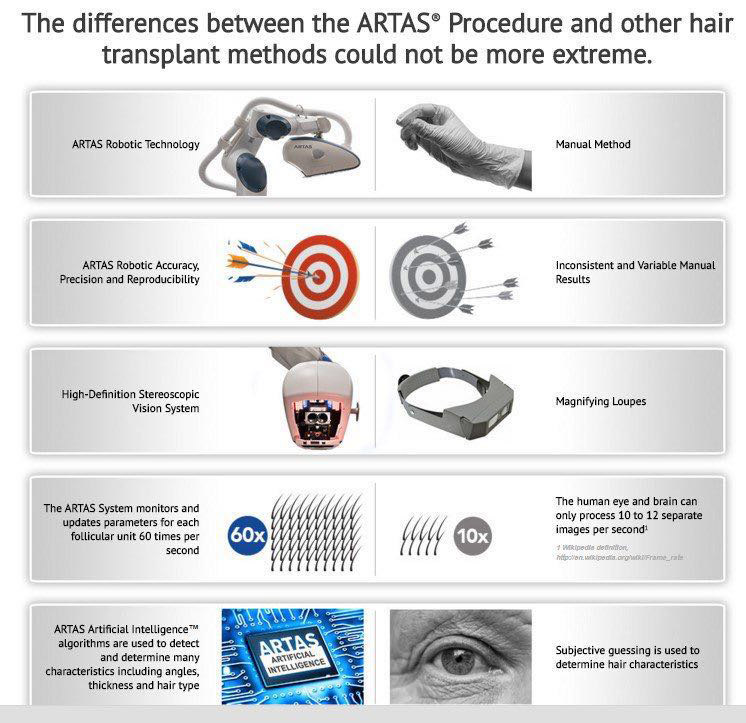 ARTAS Robotic hair transplant vs manual hair transplant Comparison By Musk Hair transplant clinic in Ahmedabad