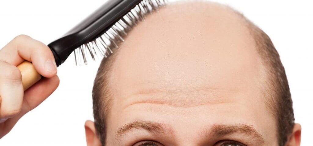 ARTAS 9X Robotic Hair Restoration Treatment