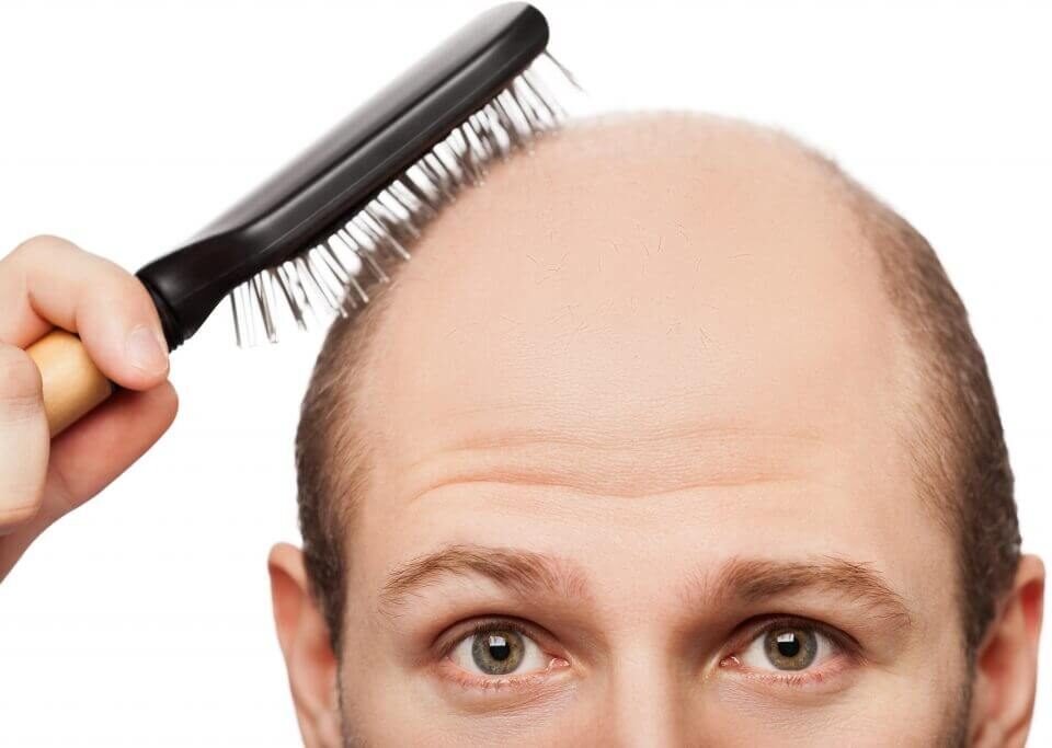 ARTAS 9X Robotic Hair Restoration Treatment