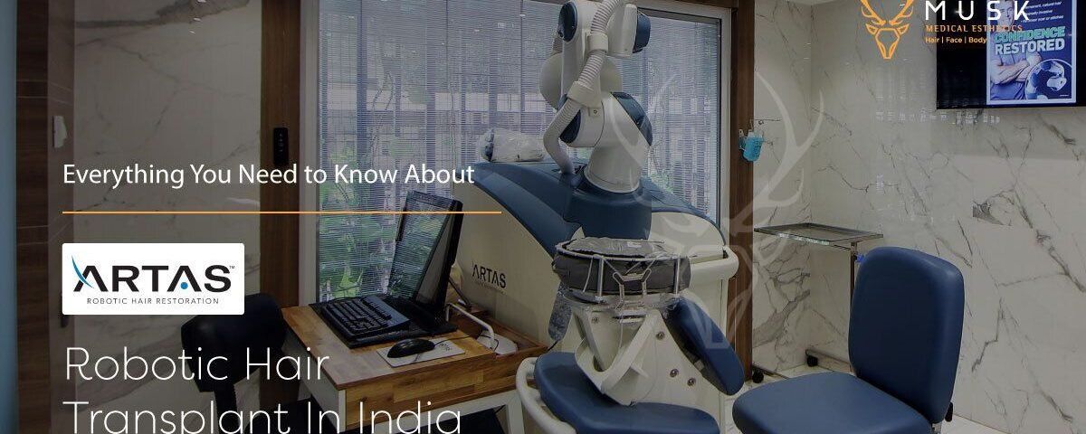 Everything You Need to Know About ARTAS Robotic Hair Transplant In India