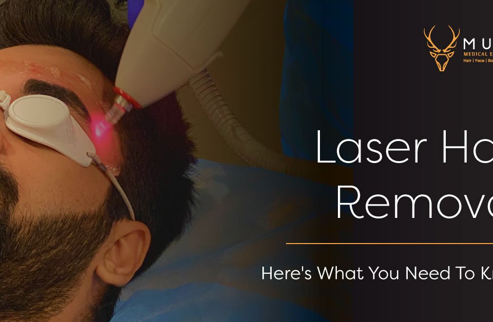 Laser Hair Removal – Here’s What Your Need To Know