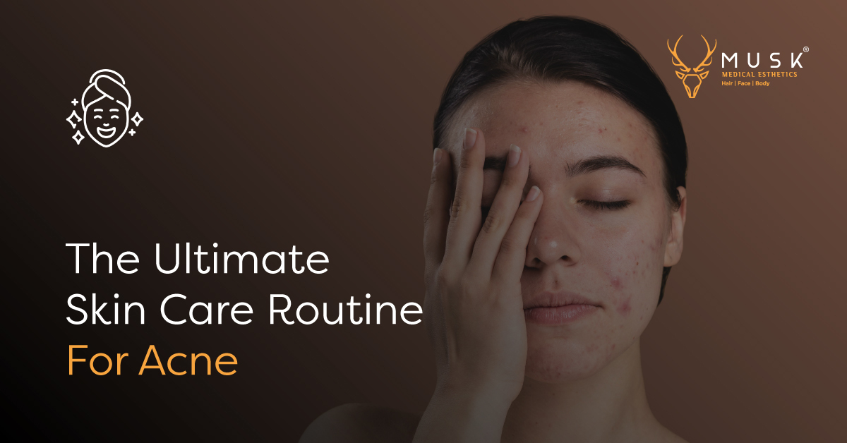 The Ultimate Skin Care Routine For Acne