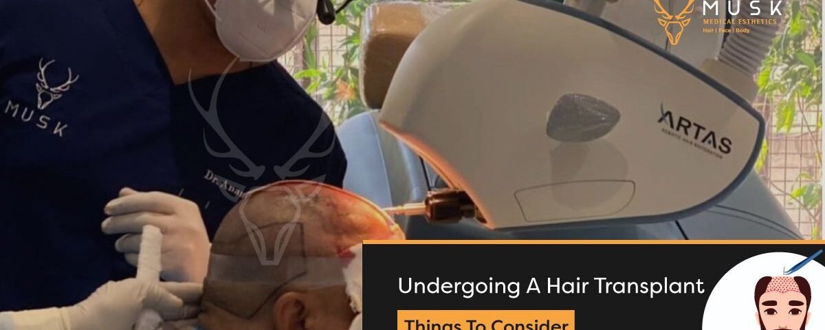 Undergoing A Hair Transplant Things To Consider