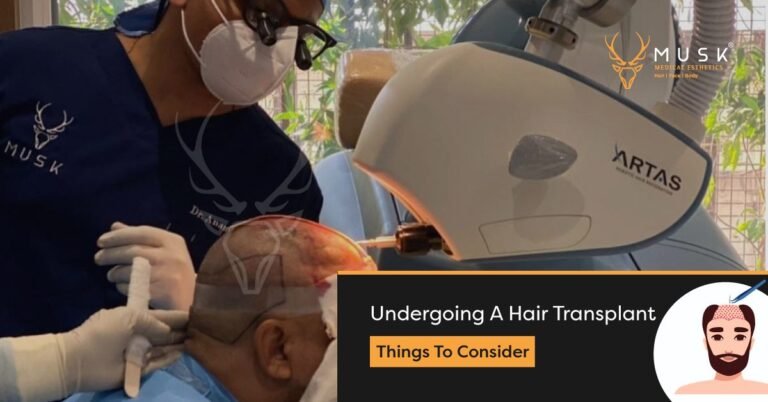 Undergoing A Hair Transplant Things To Consider