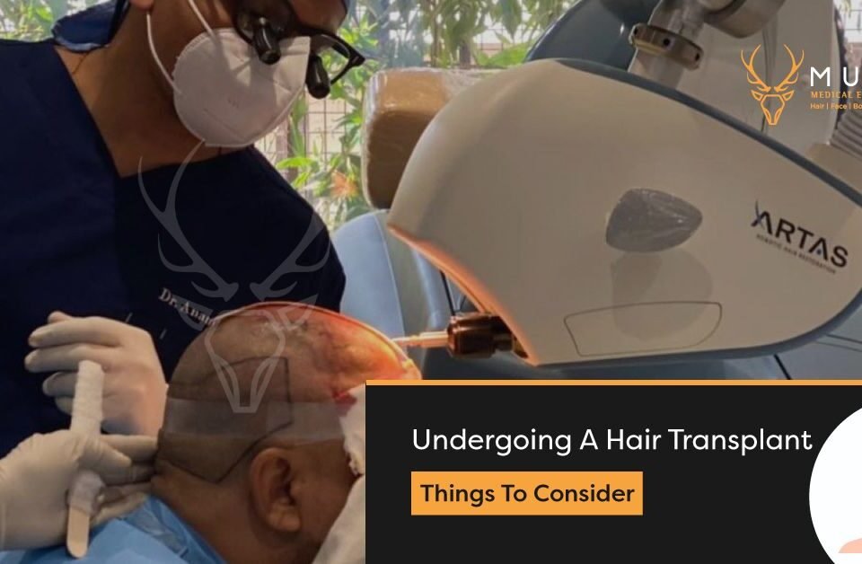 Undergoing A Hair Transplant Things To Consider