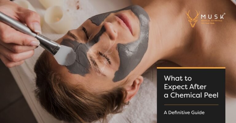 What to Expect After a Chemical Peel - A Definitive Guide