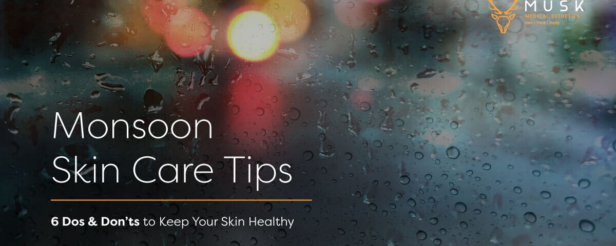 Monsoon Skin Care Tips - 6 Dos & Don’ts to Keep Your Skin Healthy