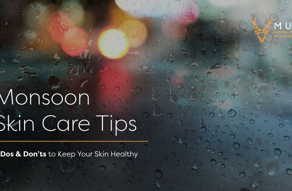 Monsoon Skin Care Tips - 6 Dos & Don’ts to Keep Your Skin Healthy