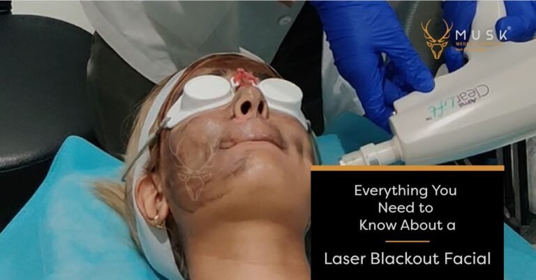 Everything You Need to Know About a Laser Blackout Facial