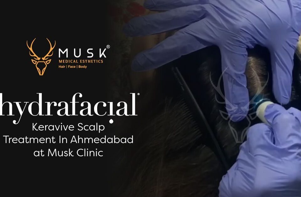 HydraFacial Keravive Scalp Treatment in Ahmedabad at Musk Clinic
