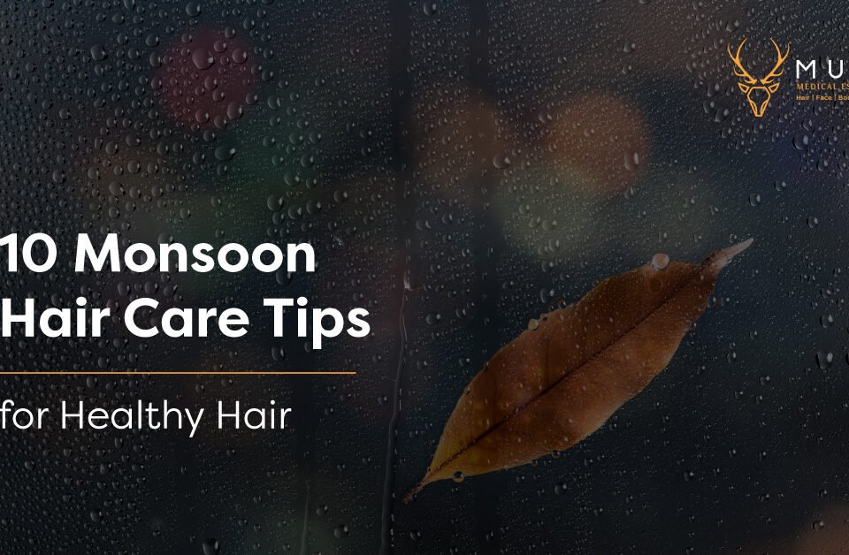 10 Monsoon Hair Care Tips for Healthy Hair