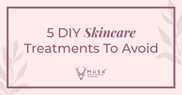 5 DIY Skincare Tips To Avoid