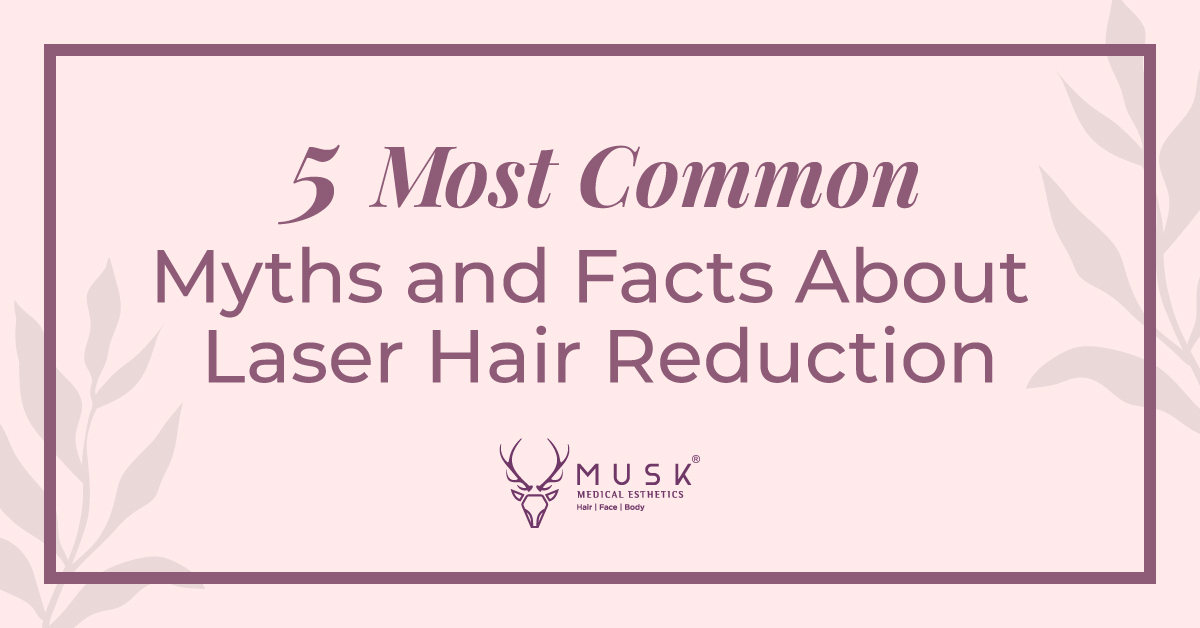 5 Most Common Myths and Facts About Laser Hair Reduction