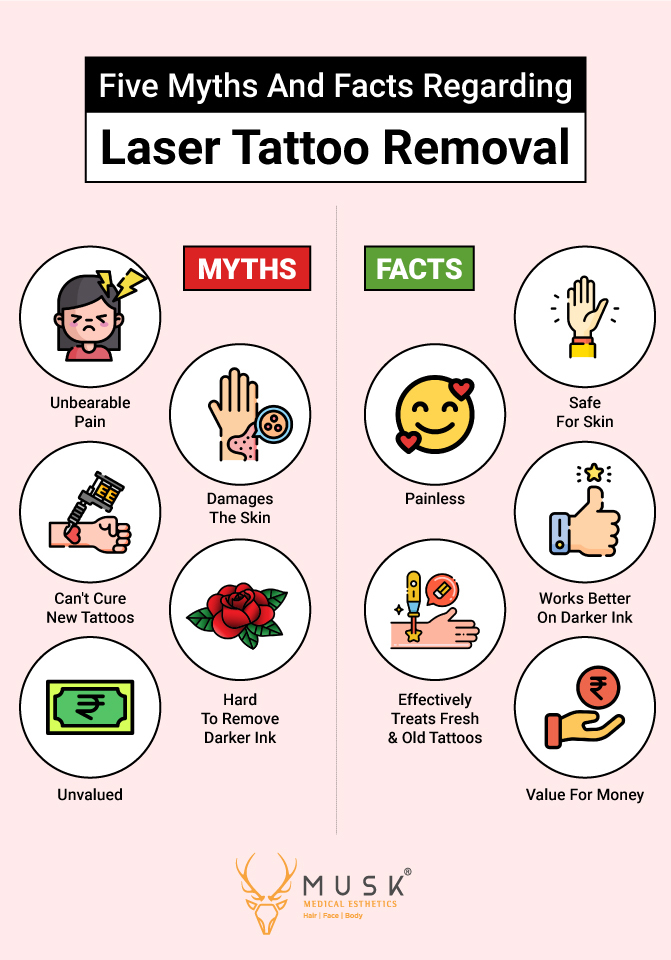 5 Myths And Facts Regarding Laser Tattoo Removal - Musk Clinic