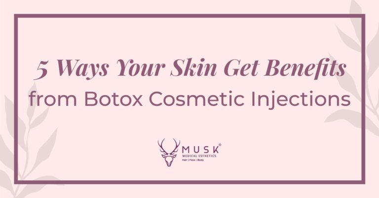 5 Ways Your Skin Get Benefits from Botox® Cosmetic Injection