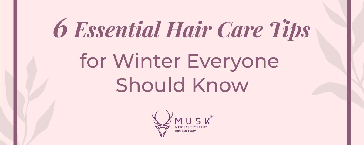 6 Essential Hair Care Tips for Winter Everyone Should Know