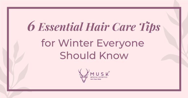 6 Essential Hair Care Tips for Winter Everyone Should Know