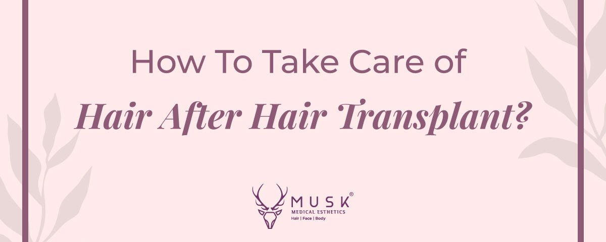 How To Take Care of Hair After A Hair Transplant - An Informative Guide