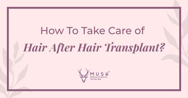 How To Take Care of Hair After A Hair Transplant - An Informative Guide