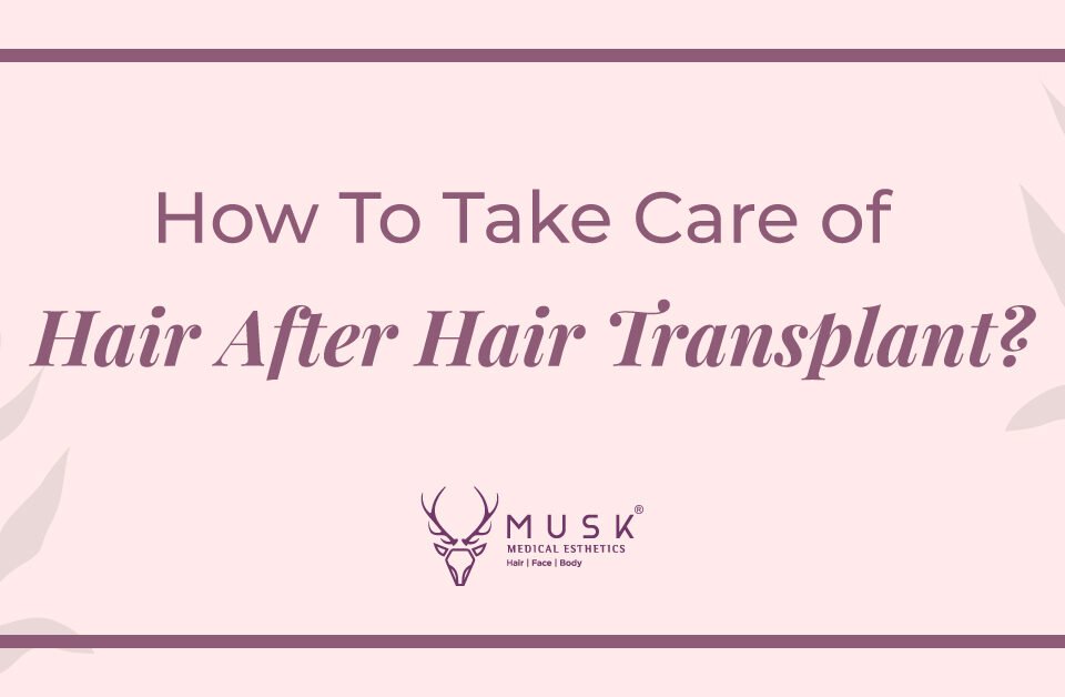 How To Take Care of Hair After A Hair Transplant - An Informative Guide