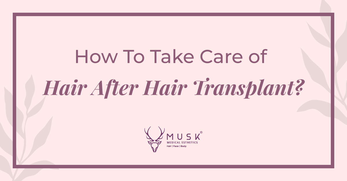 How to take care of your hair after a hair transplant