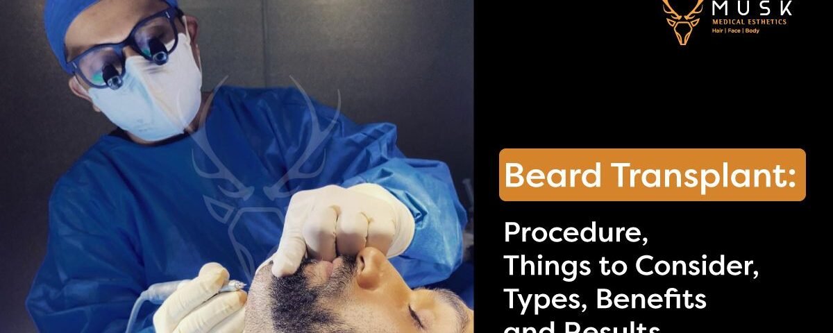 Beard Transplant Procedure, Things to Consider, Types, Benefits, and Results