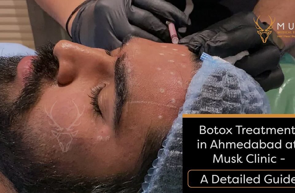 Botox Treatment in Ahmedabad at Musk Clinic - A Detailed Guide