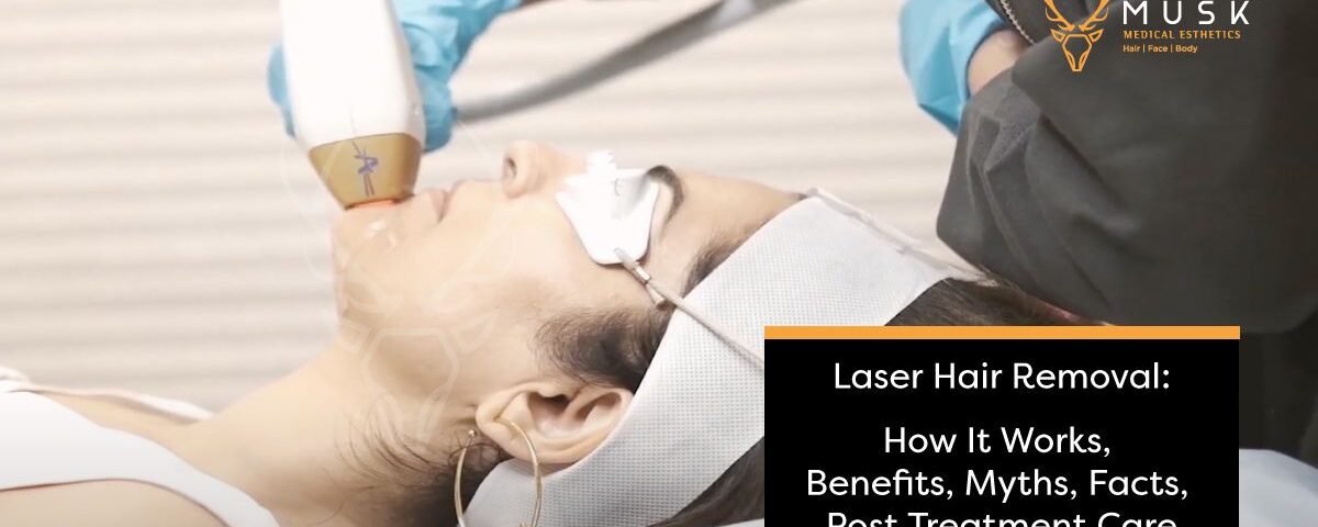 Laser Hair Removal How It Works, Benefits, Myths, Facts, Post Treatment Care, and Cost
