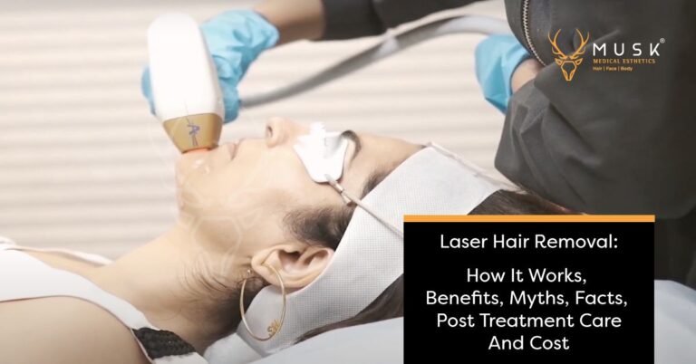 Laser Hair Removal How It Works, Benefits, Myths, Facts, Post Treatment Care, and Cost