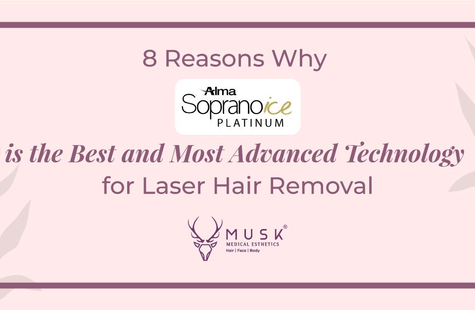 8 Reasons Why Alma Soprano Ice Platinum is the Best and Most Advanced Technology for Laser Hair Removal