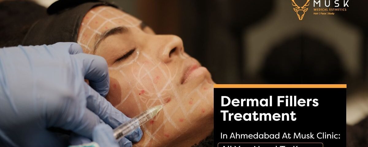 Dermal Fillers Treatment In Ahmedabad At Musk Clinic All You Need To Know