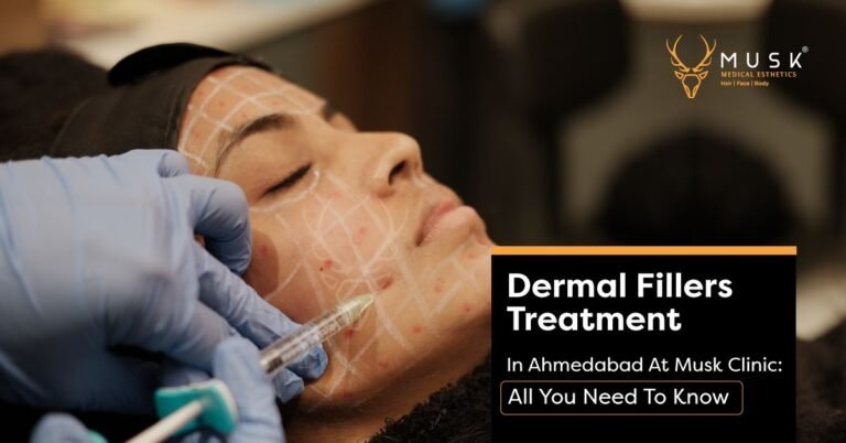 Dermal Fillers Treatment In Ahmedabad At Musk Clinic All You Need To Know