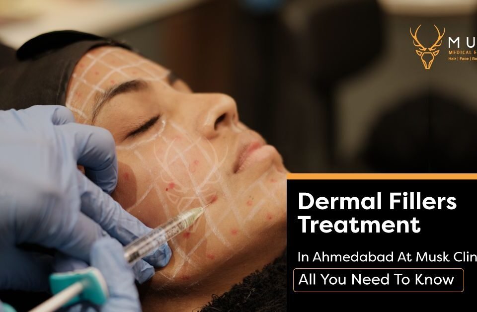 Dermal Fillers Treatment In Ahmedabad At Musk Clinic All You Need To Know