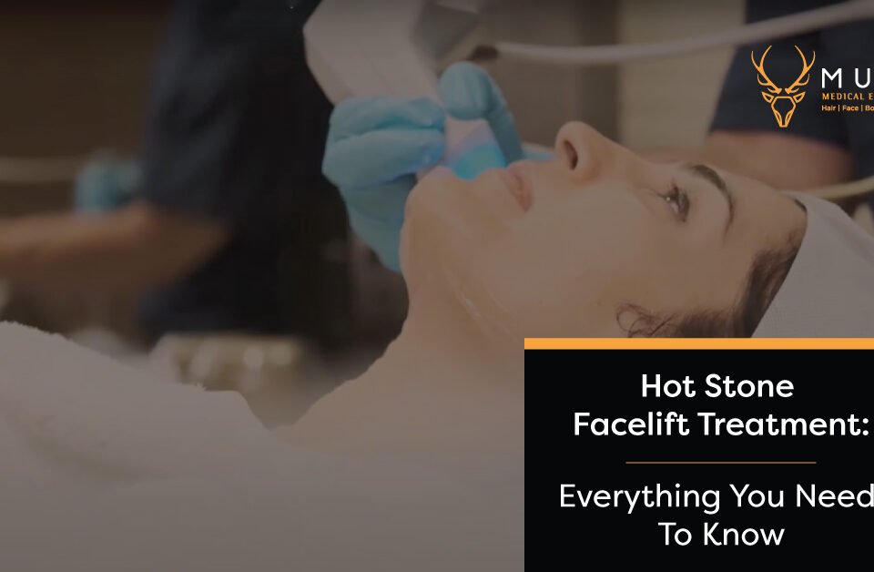 Hot Stone Facelift Treatment Everything You Need To Know