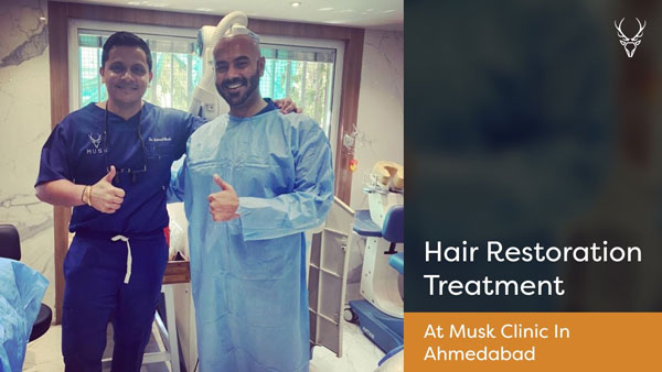 Hair Transplant in Ahmedabad, Hair Transplant Cost, Hair Treatment