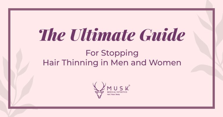 The Ultimate Guide for Stopping Hair Thinning in Men and Women