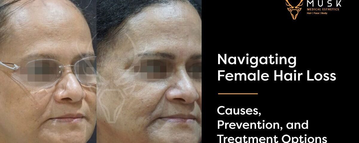 Navigating Female Hair Loss Causes, Prevention, and Treatment Options