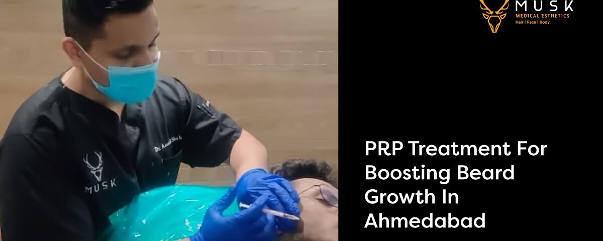 PRP Treatment for boosting beard growth in Ahmedabad