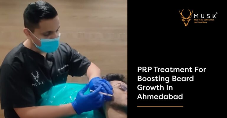 PRP Treatment for boosting beard growth in Ahmedabad