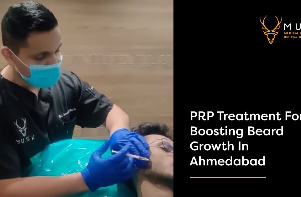 PRP Treatment for boosting beard growth in Ahmedabad