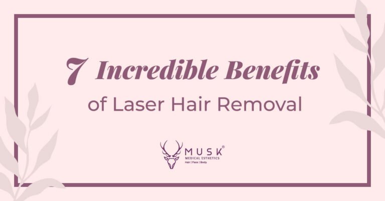 7 Incredible Benefits of Laser Hair Removal