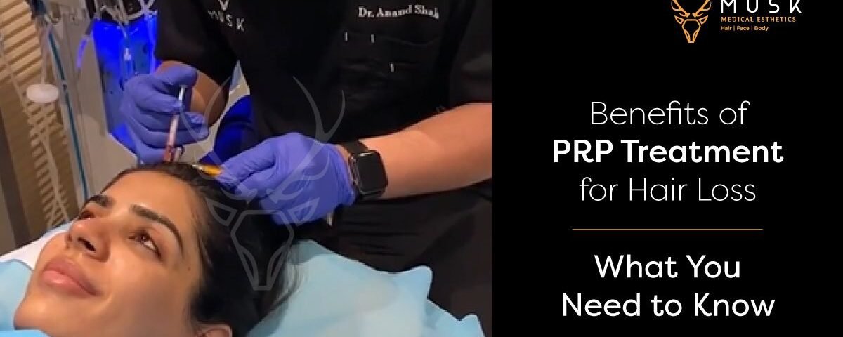 Benefits of PRP Treatment for Hair Loss What You Need to Know