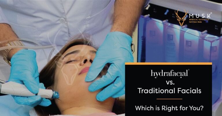 Hydrafacial vs. Traditional Facials Which is Better for You
