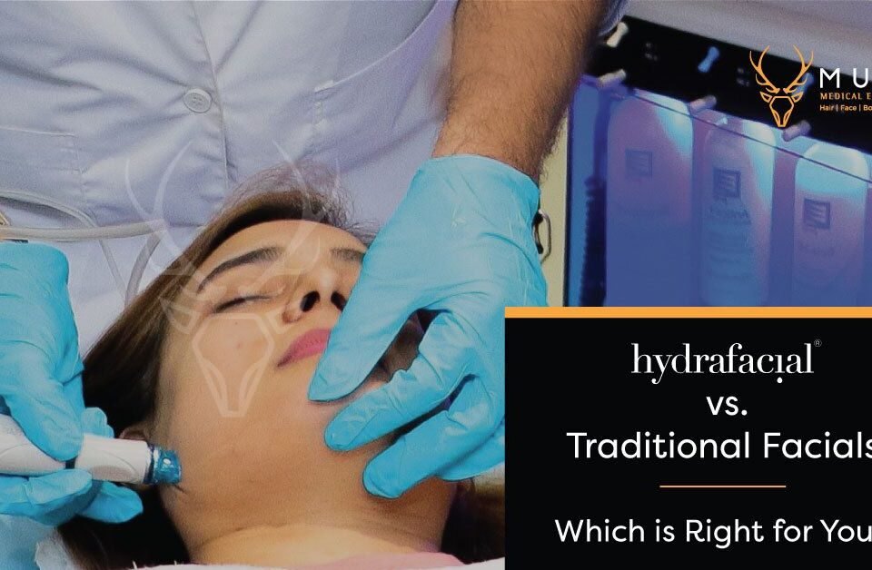 Hydrafacial vs. Traditional Facials Which is Better for You