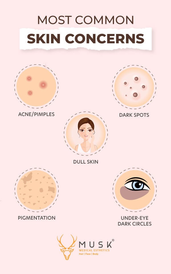 Common Skin Concerns