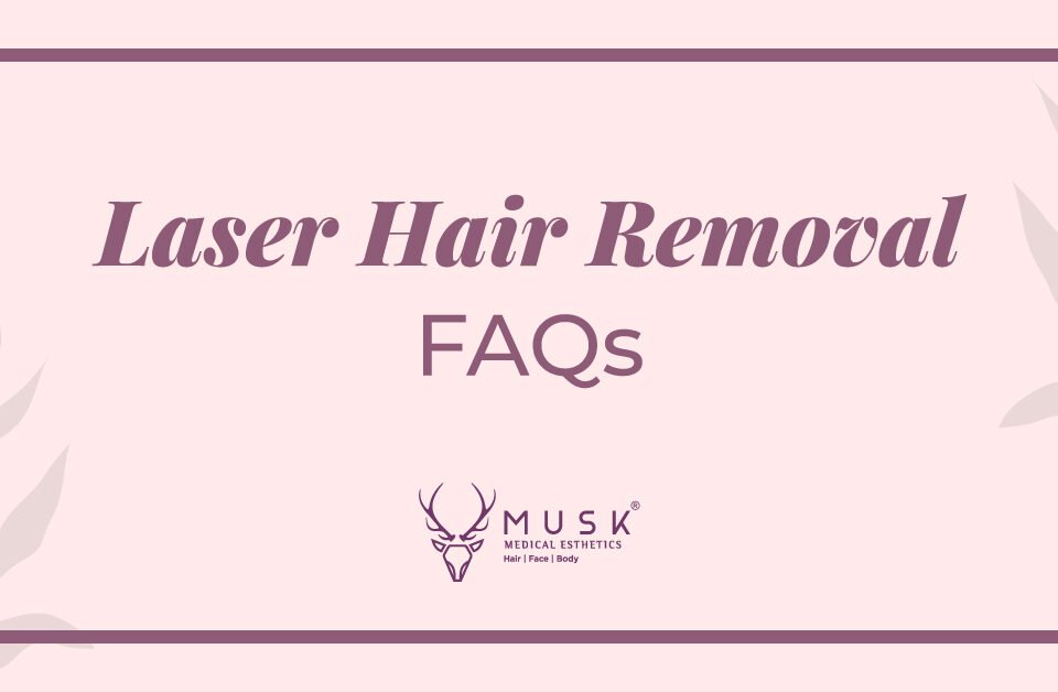 Laser-Hair-Removal