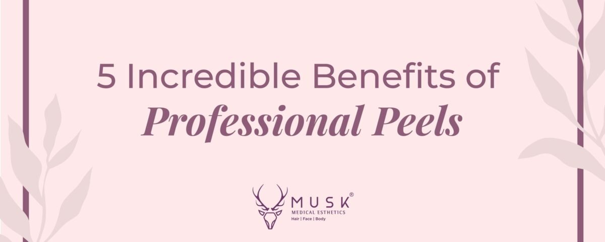 5 Incredible Benefits of Professional Peels