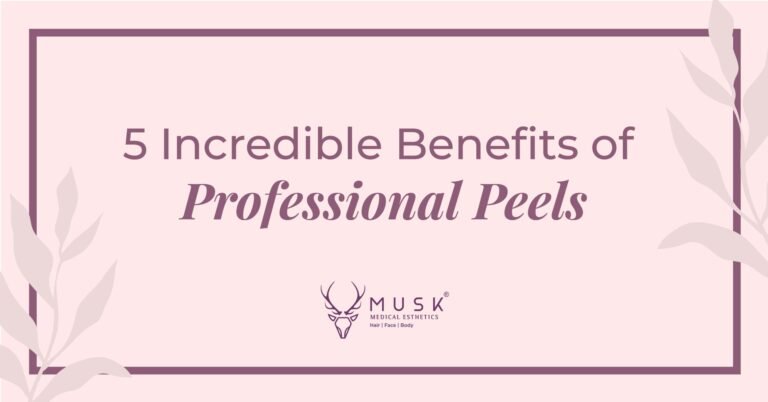 5 Incredible Benefits of Professional Peels